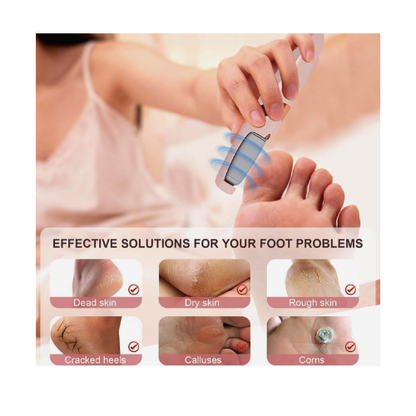 Electric Pedicure Foot File – Rechargeable Callus Remover for Smooth Feet
