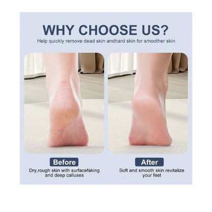 Rechargeable Electric Callus Remover – Waterproof Foot File with 2 Rollers & Display Screen