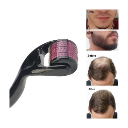 Derma Roller System: Unlock Radiant Skin with Expert - megamartuae