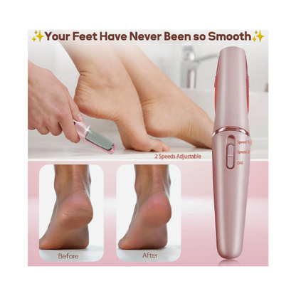 Electric Pedicure Foot File – Rechargeable Callus Remover for Smooth Feet - megamartuae