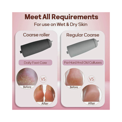 Electric Pedicure Foot File – Rechargeable Callus Remover for Smooth Feet - megamartuae