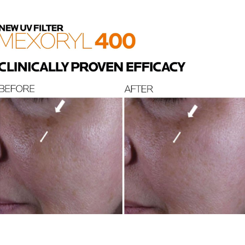 La Roche-Posay Anthelios UVMune 400 SPF50+ Sunscreen - megamartuae