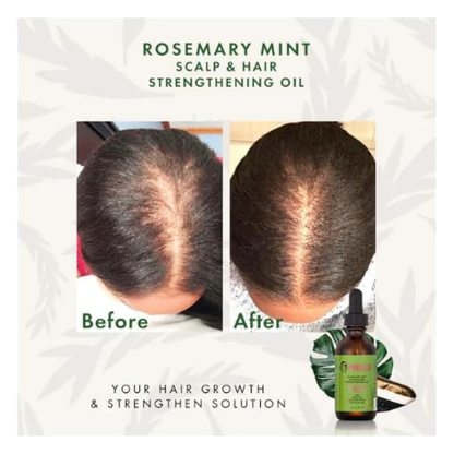 Rosemary Mint Scalp & Hair Strengthening Oil – Nourishing Growth & Repair Treatment (Original) - megamartuae