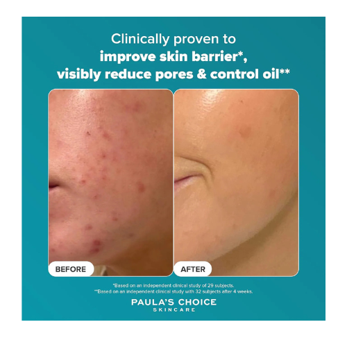 Skin Perfecting 2% BHA Liquid Exfoliant – 118ml - megamartuae