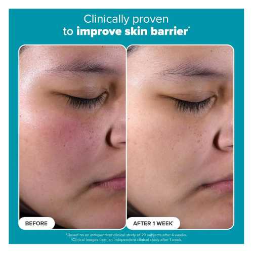 Skin Perfecting 2% BHA Liquid Exfoliant – 118ml - megamartuae