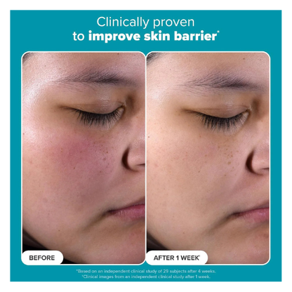 Skin Perfecting 2% BHA Liquid Exfoliant – 118ml - megamartuae